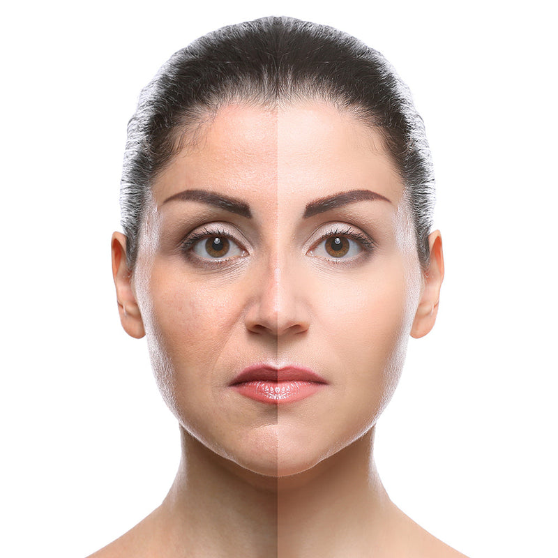 PhotoAging. What? When? Why? How? – European Beauty Studio